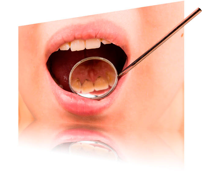 dental
