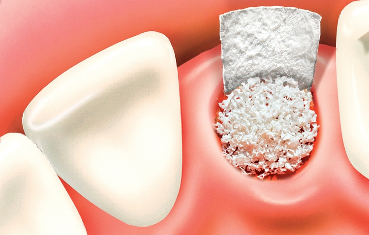 dental
